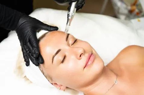 Microneedling – Derma FNS™ Pen
